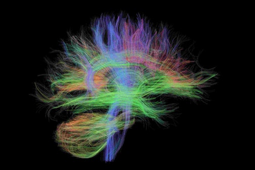 Learning and the brain